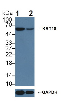 角蛋白18(CK18)多克隆抗體