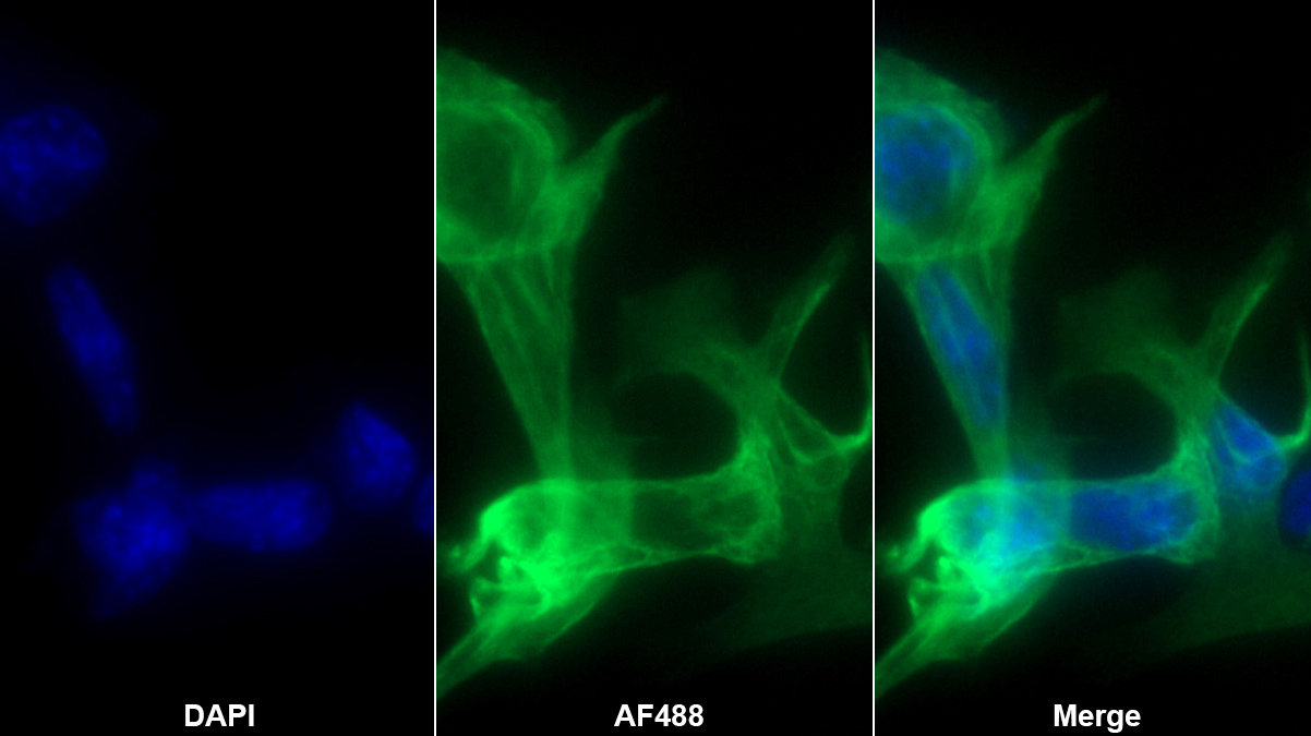 角蛋白18(CK18)多克隆抗體