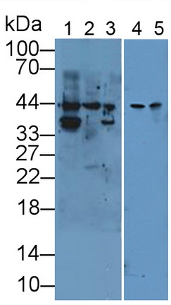 角蛋白19(CK19)多克隆抗體