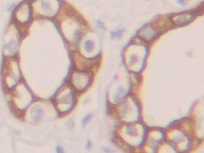 角蛋白19(CK19)多克隆抗體