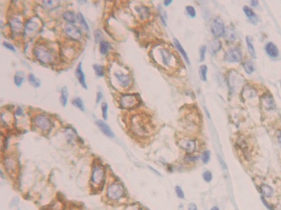 角蛋白19(CK19)多克隆抗體