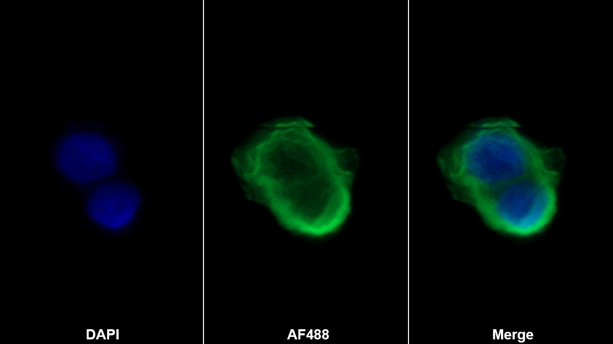角蛋白19(CK19)多克隆抗體