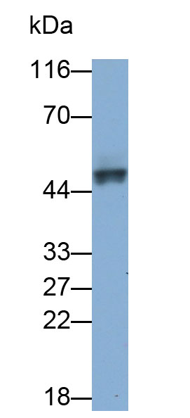 角蛋白19(CK19)多克隆抗體