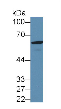 谷氨酸脫羧酶2(GAD2)多克隆抗體