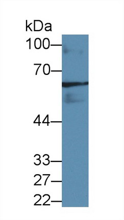 谷氨酸脫羧酶2(GAD2)多克隆抗體