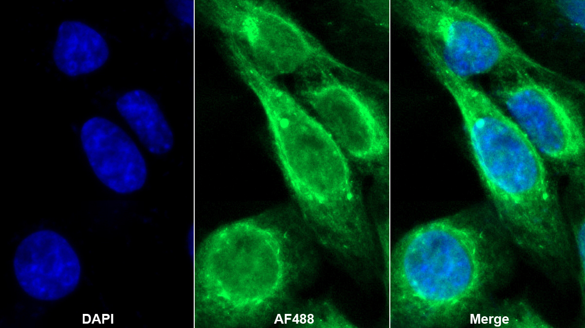 谷氨酸脫羧酶2(GAD2)多克隆抗體