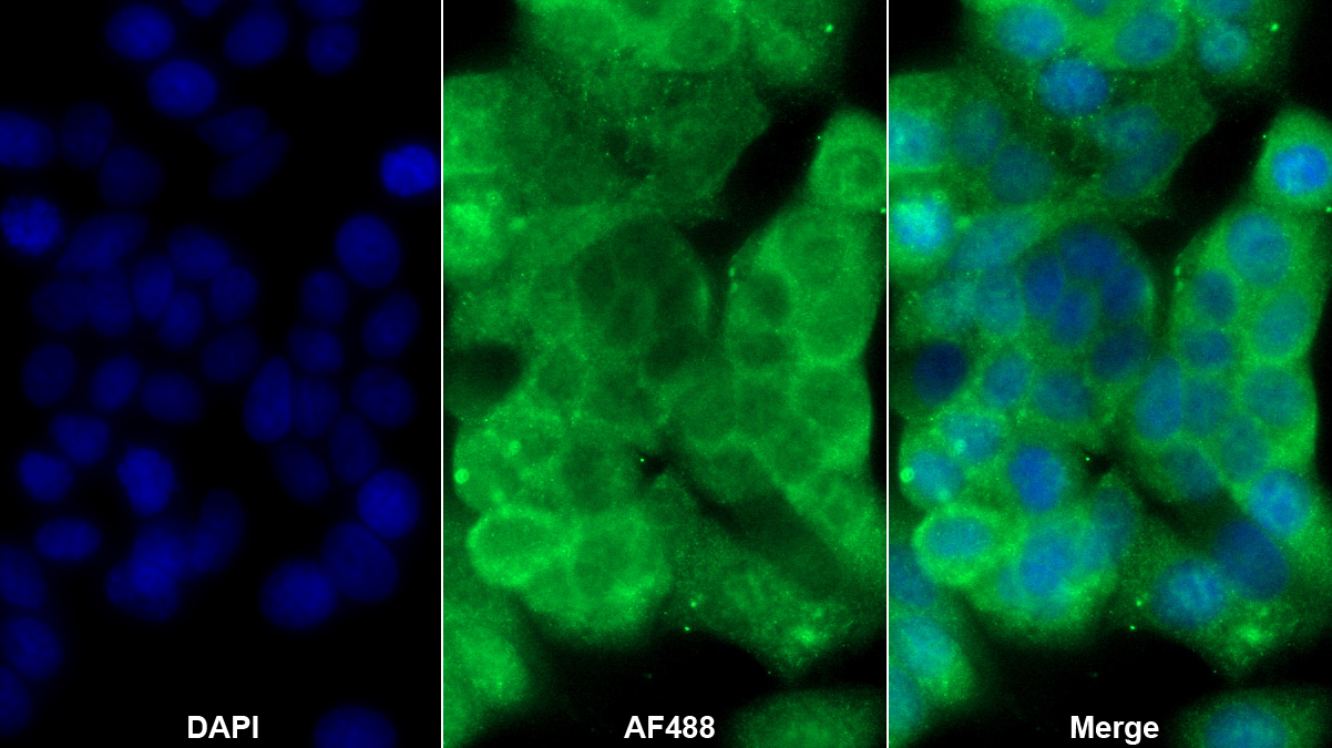 组织蛋白酶D(CTSD)多克隆抗体