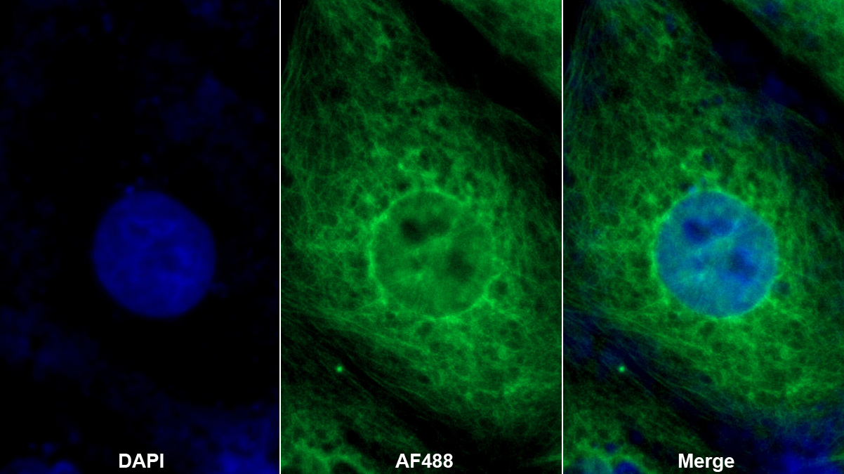 野鼠色基因相關(guān)蛋白(AGRP)多克隆抗體