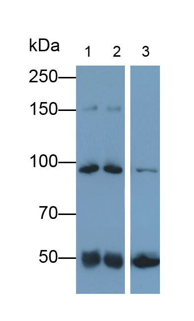 补体4B(C4B)多克隆抗体