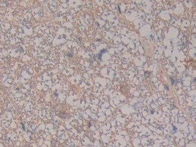 补体成分8β(C8b)多克隆抗体