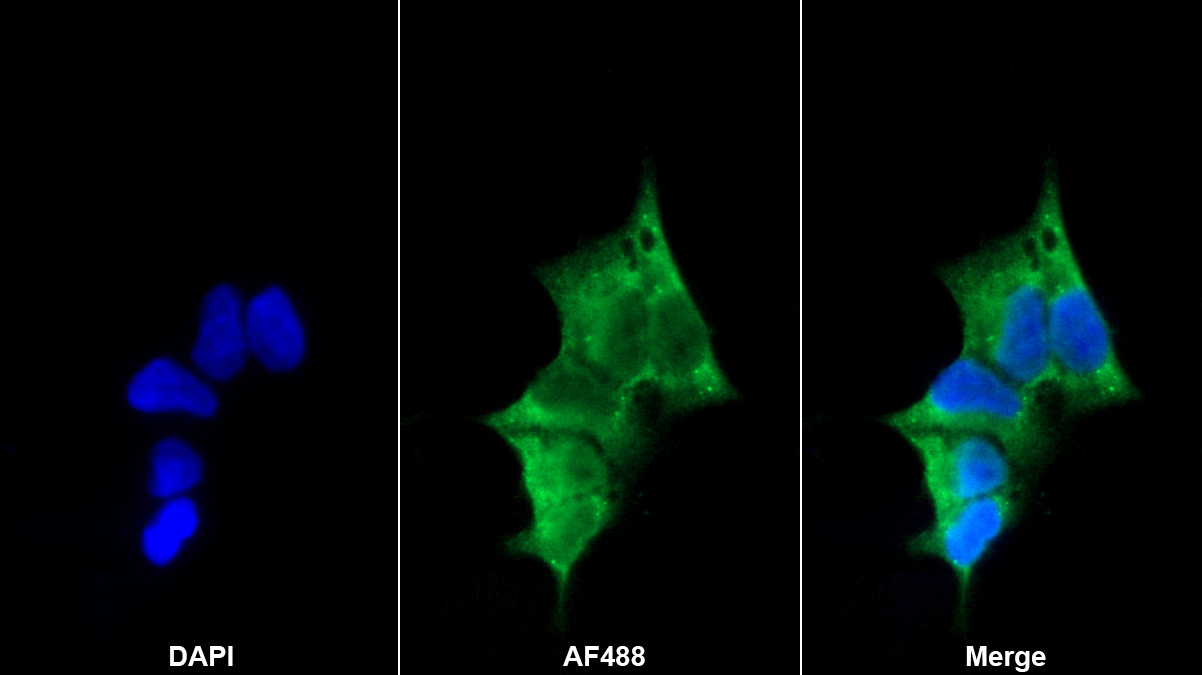 前膠原C端蛋白酶增強(qiáng)子(PCOLCE)多克隆抗體