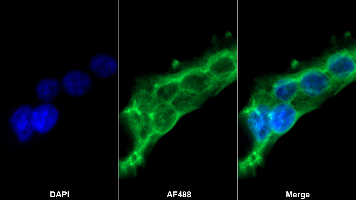 穿孔素1(PRF1)多克隆抗体