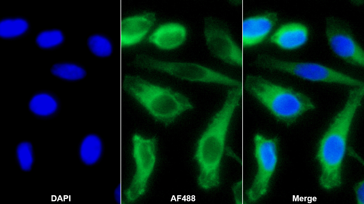 鈣調(diào)結(jié)合蛋白(CALD)多克隆抗體