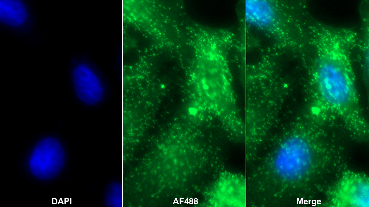 钙调结合蛋白(CALD)多克隆抗体
