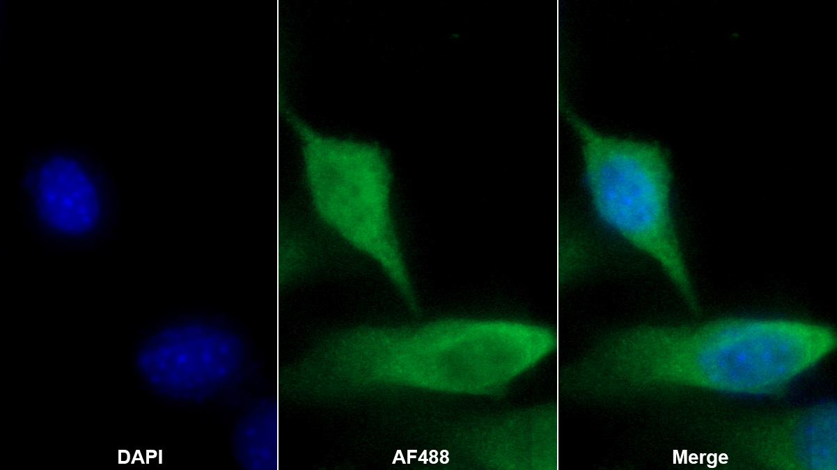 套膜蛋白(INV)多克隆抗體