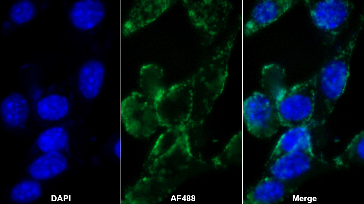 彈性蛋白(ELN)多克隆抗體