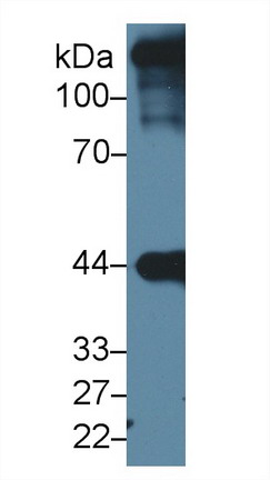 心肌肌動蛋白α1(ACTC1)多克隆抗體