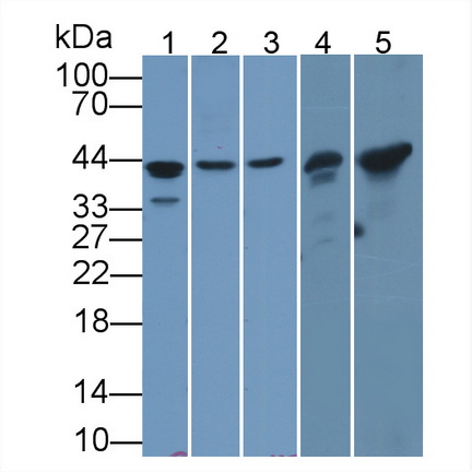 心肌肌動蛋白α1(ACTC1)多克隆抗體