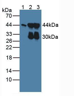 平滑肌肌动蛋白γ2(ACTg2)多克隆抗体