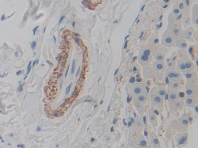 平滑肌肌动蛋白γ2(ACTg2)多克隆抗体