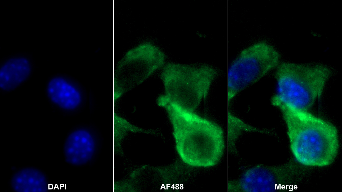 巨噬細(xì)胞表達(dá)基因1蛋白(MPG1)多克隆抗體