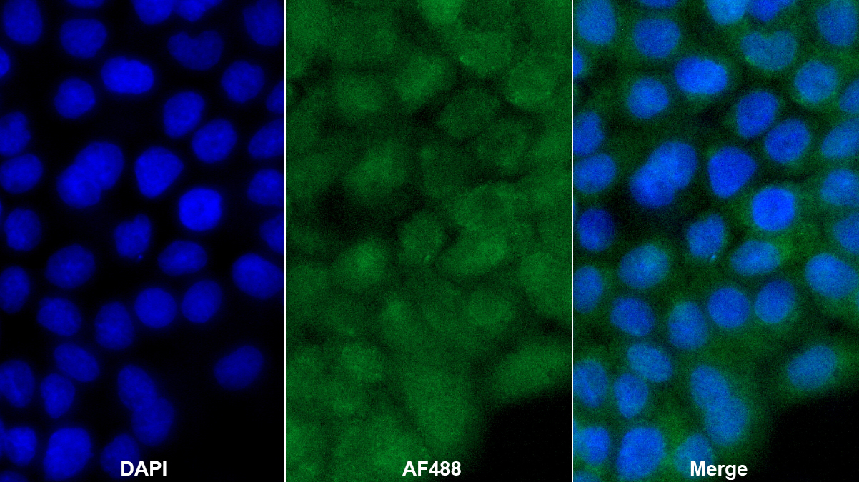 葡萄糖激酶調(diào)節(jié)蛋白(GKRP)多克隆抗體