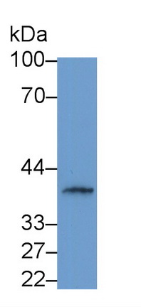 γ-谷氨酰转移酶1(gGT1)多克隆抗体
