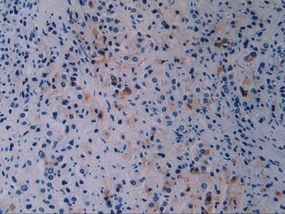 乳腺癌易感蛋白1(BRCA1)多克隆抗体