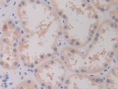 乳腺癌易感蛋白1(BRCA1)多克隆抗体