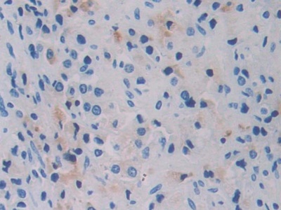 乳腺癌易感蛋白1(BRCA1)多克隆抗体