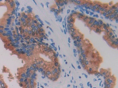 乳腺癌易感蛋白1(BRCA1)多克隆抗体