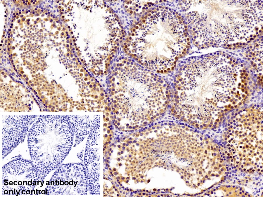 乳腺癌易感蛋白1(BRCA1)多克隆抗体