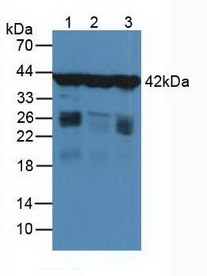 肌動蛋白γ1(ACTG)多克隆抗體