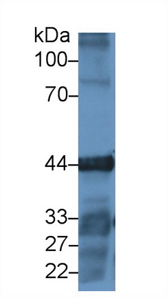 肌動蛋白γ1(ACTG)多克隆抗體