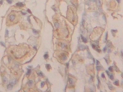 肌動蛋白γ1(ACTG)多克隆抗體