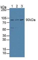 轉(zhuǎn)錄激活因子6(ATF6)多克隆抗體