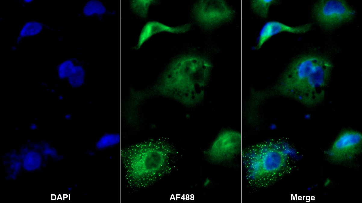 血小板激活因子乙酰水解酶Ⅰb3(PAFAH1B3)多克隆抗體