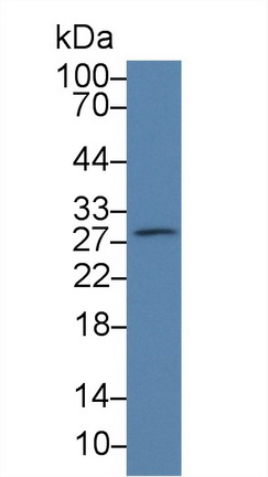 血小板激活因子乙酰水解酶Ⅰb3(PAFAH1B3)多克隆抗体