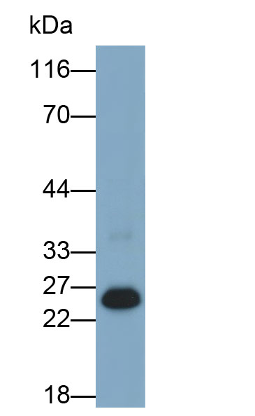 蛋白酶3(PR3)多克隆抗體