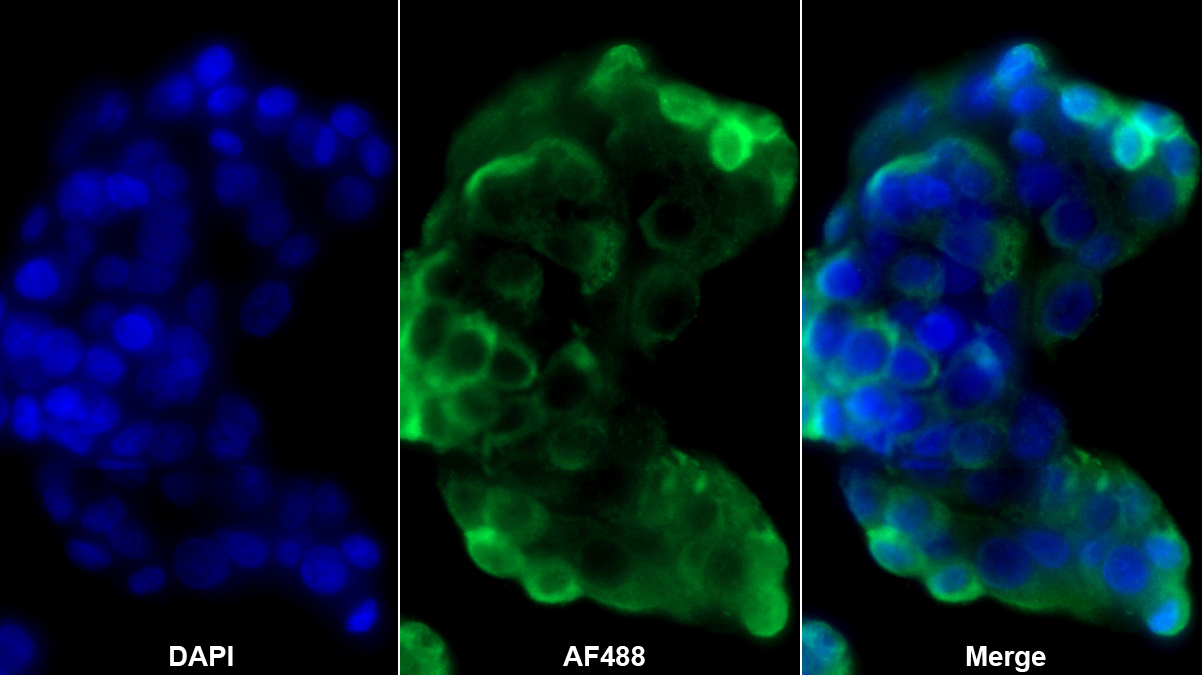 非神經(jīng)元性烯醇化酶(ENO1)多克隆抗體