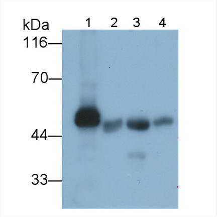 胰淀粉酶α2(AMY2A)多克隆抗体