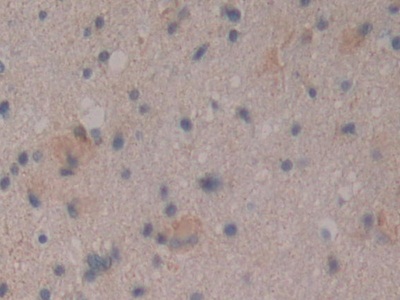 CD109分子(CD109)多克隆抗体
