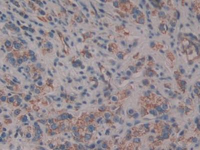 CD109分子(CD109)多克隆抗体