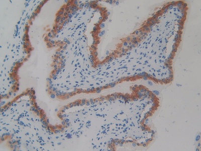 CD109分子(CD109)多克隆抗體