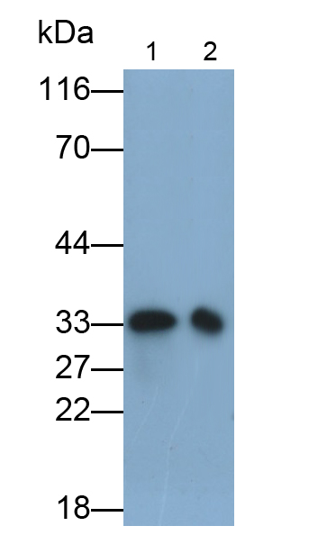 甘露糖結合蛋白(MBL)多克隆抗體