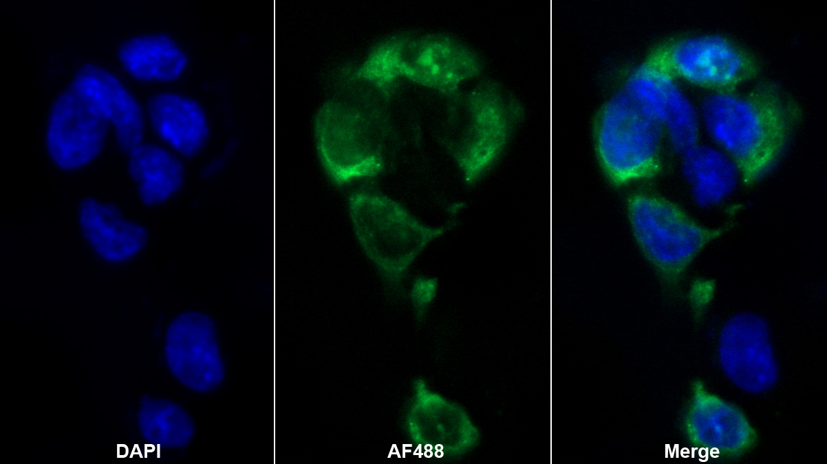 神經(jīng)鈣黏蛋白(NCAD)多克隆抗體