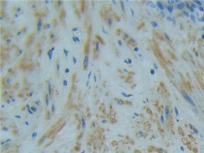 腫瘤壞死因子受體超家族成員1A(TNFR1)多克隆抗體