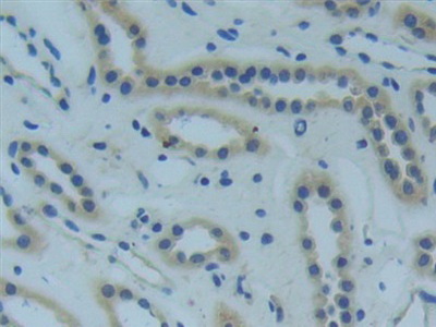 腫瘤壞死因子受體超家族成員1A(TNFR1)多克隆抗體
