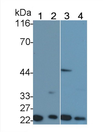 肿瘤坏死因子受体超家族成员1A(TNFR1)多克隆抗体