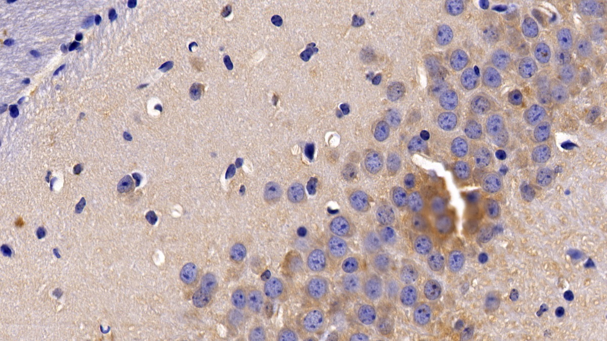 腫瘤壞死因子受體超家族成員1A(TNFR1)多克隆抗體